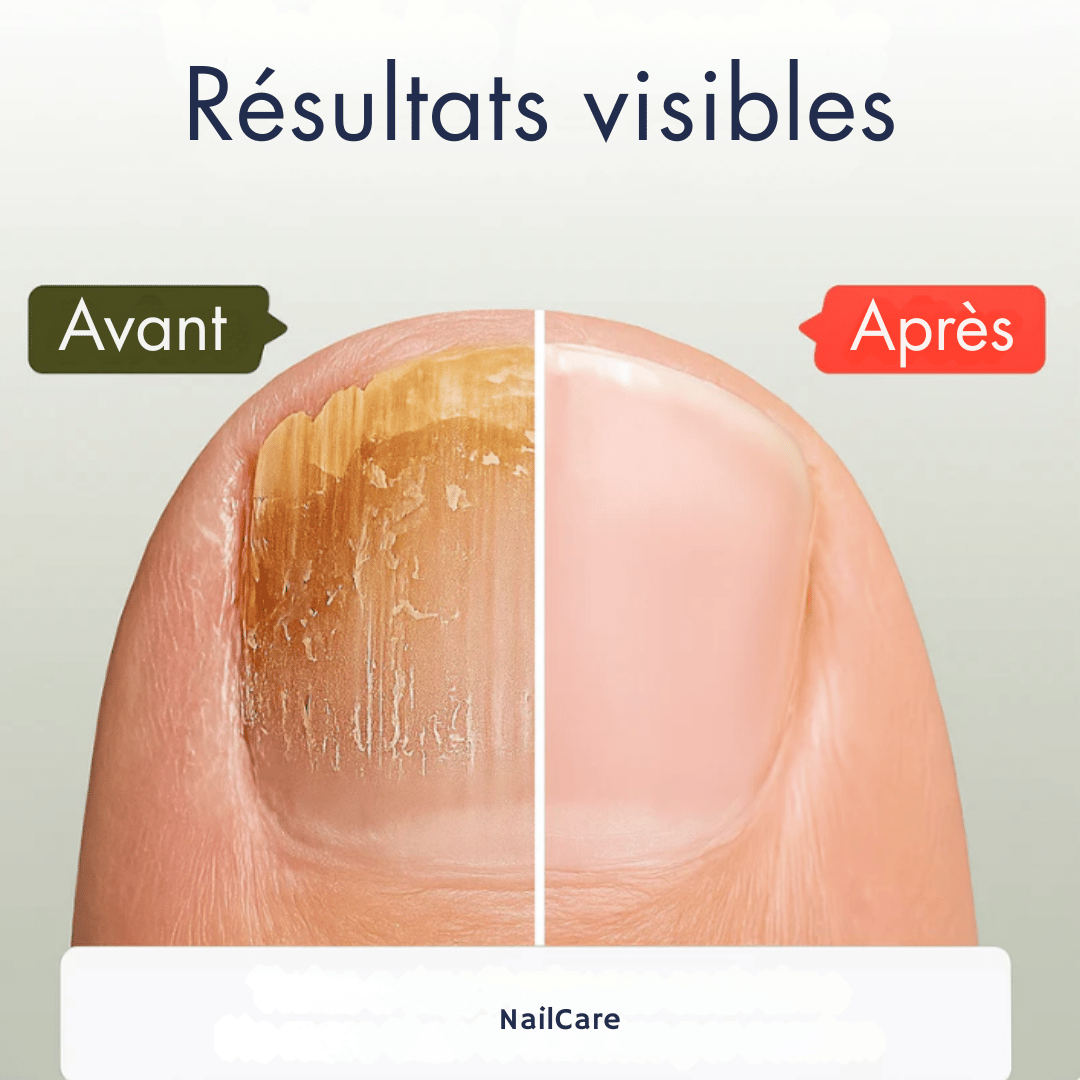 NailCare – Sérum Réparateur d’Ongles