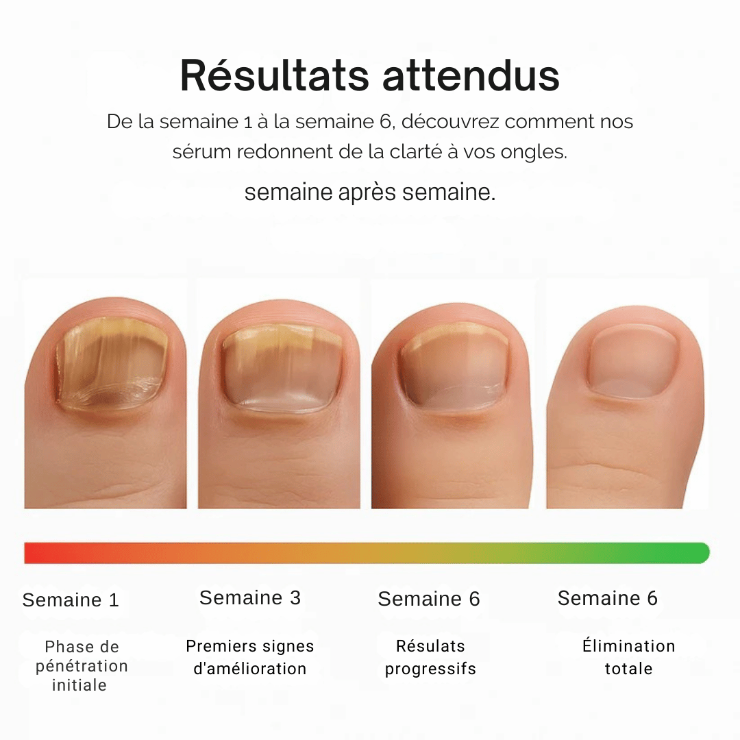 NailCare – Sérum Réparateur d’Ongles